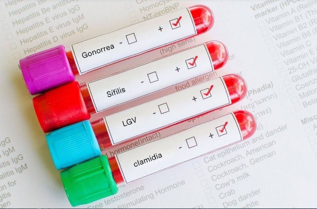 Spagna: in forte aumento gonorrea e clamidia tra gli under 25
